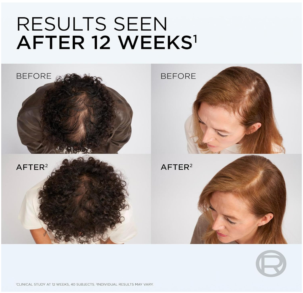 L'Oreal Paris Elvive Growth Booster Scalp Serum, Anti Hair Loss Scalp Treatment, with Aminexil, Nianimacide and Ginger Extract, Reduces Hair Loss