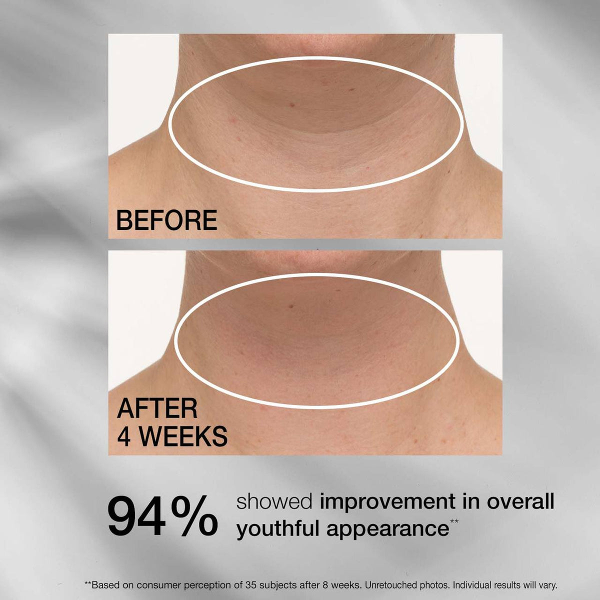 StriVectin TL Advanced Tightening Neck Cream PLUS