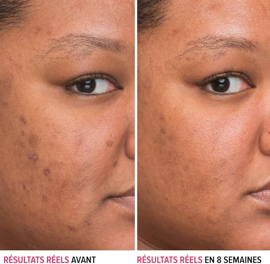 IT Cosmetics Bye Bye Dark Spots Concentrated Derma Serum 30ml