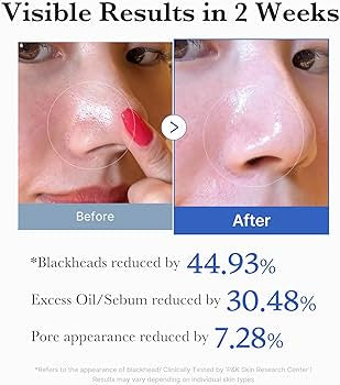 medicube Zero Pore Pad