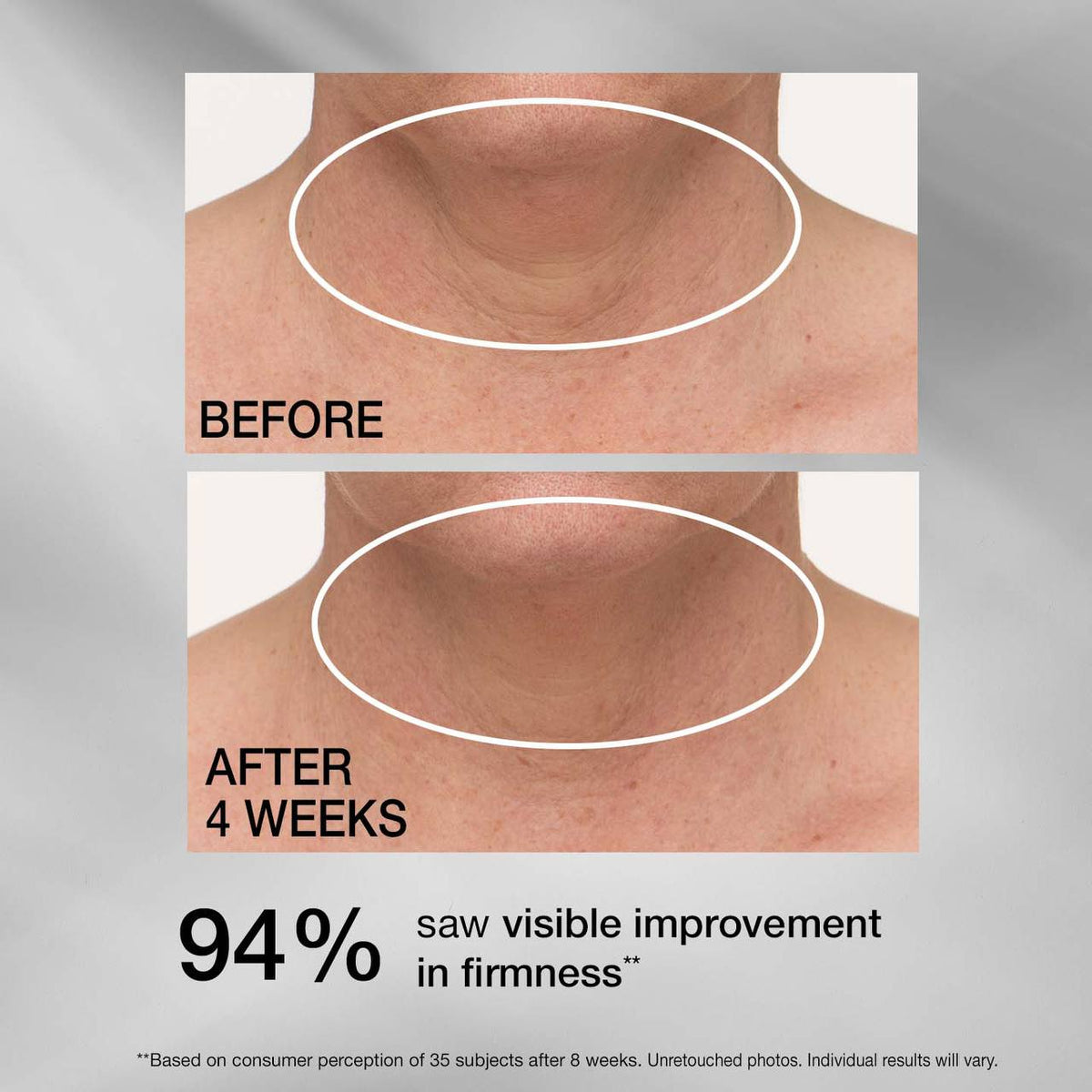 StriVectin TL Advanced Tightening Neck Cream PLUS