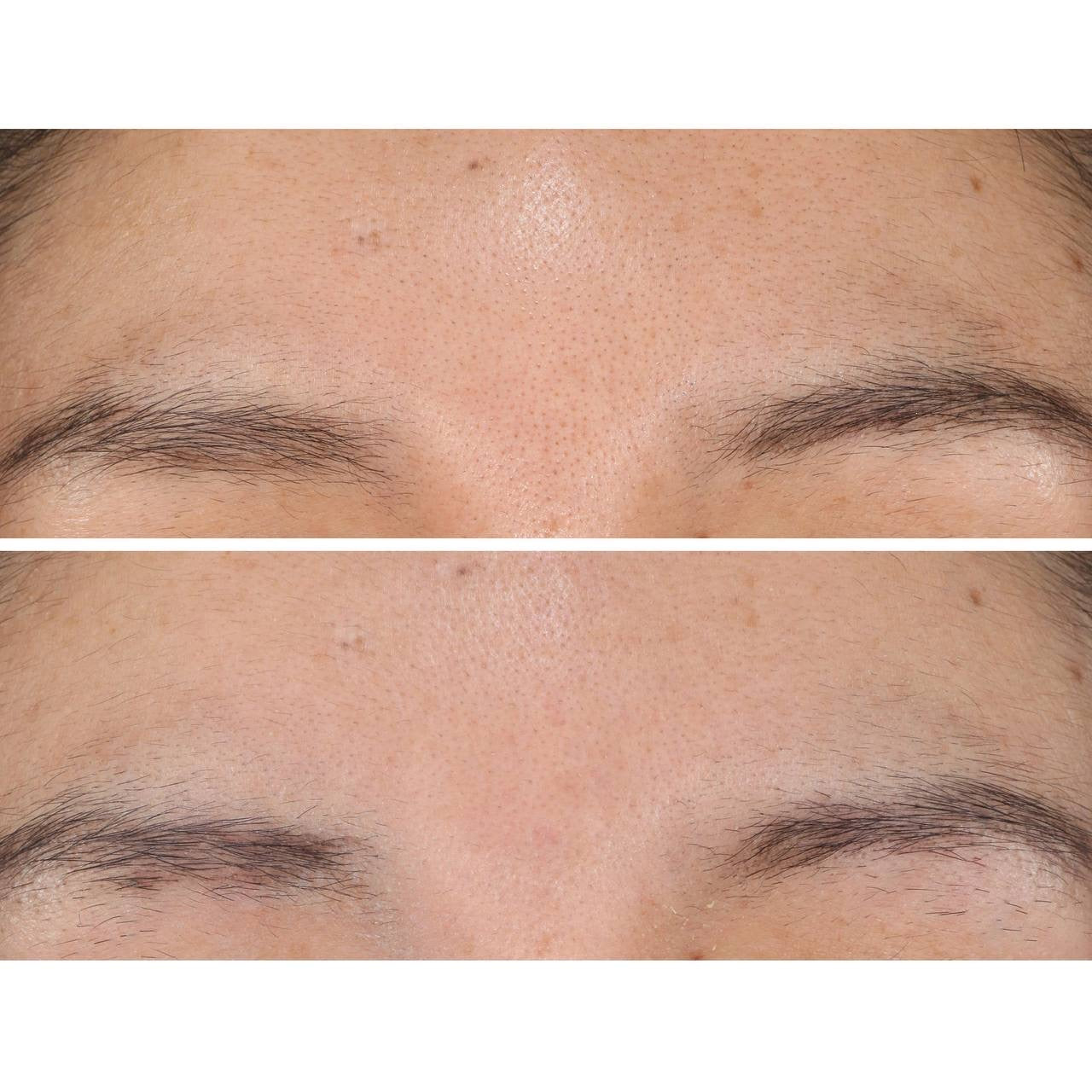Strivectin Daily Exfoliating Pads