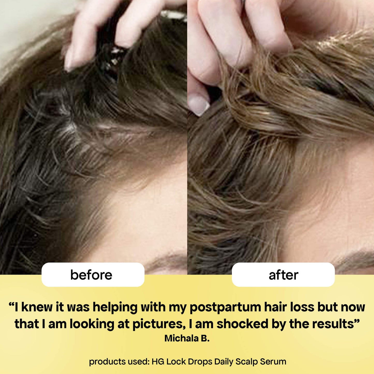 BondiBoost HG Lock Drops Daily Hair Serum 30 ml